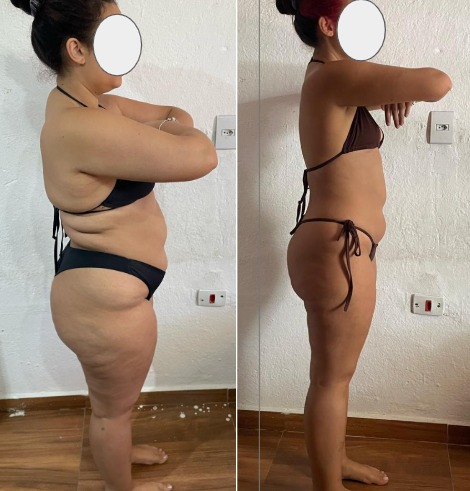 Antes e depois - transformação de paciente