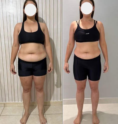 Antes e depois - transformação de paciente