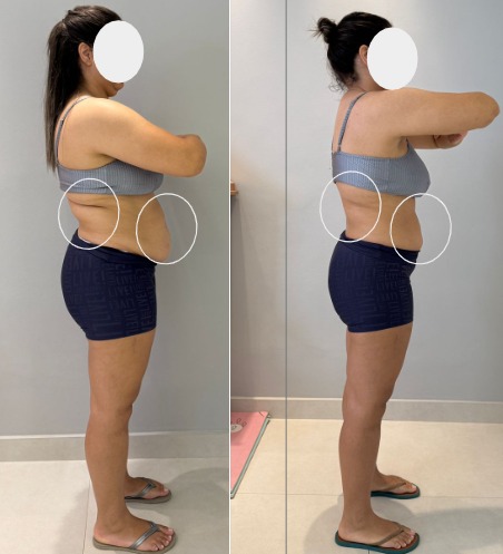 Antes e depois - transformação de paciente