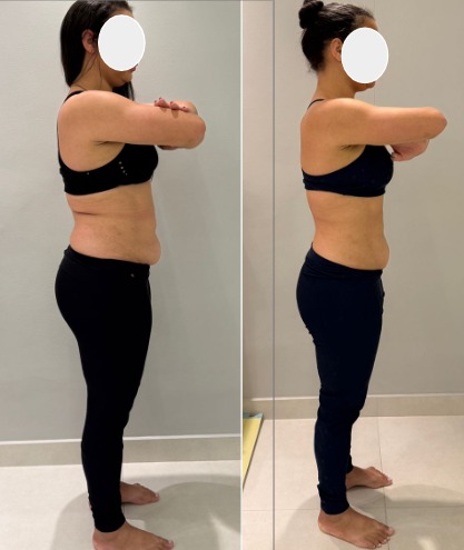 Antes e depois - transformação de paciente