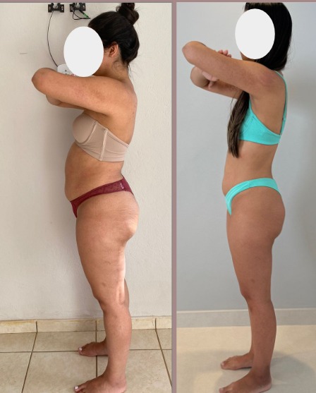 Antes e depois - transformação de paciente